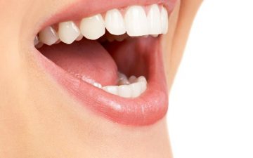 Natural proven teeth whitening strategies
