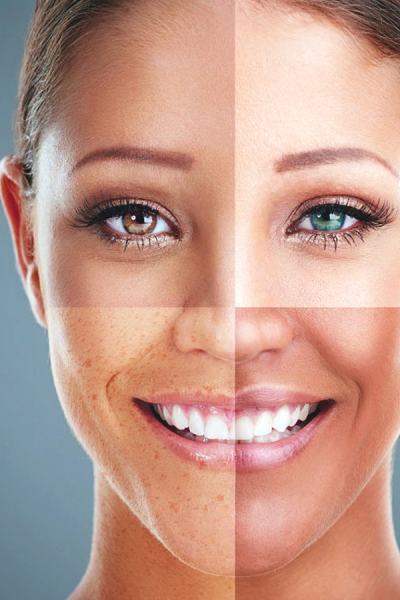 woman with combination skin type