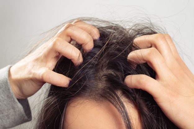 Does Hair Dye Kill Lice? How to Get Rid of Lice Using Hair Color