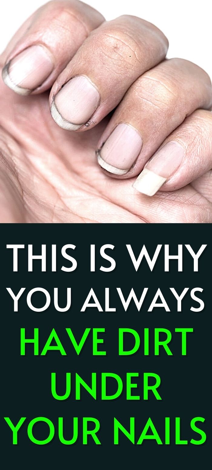 Why Do I Always Have Dirt Under My Nails & How to Get Rid of It?