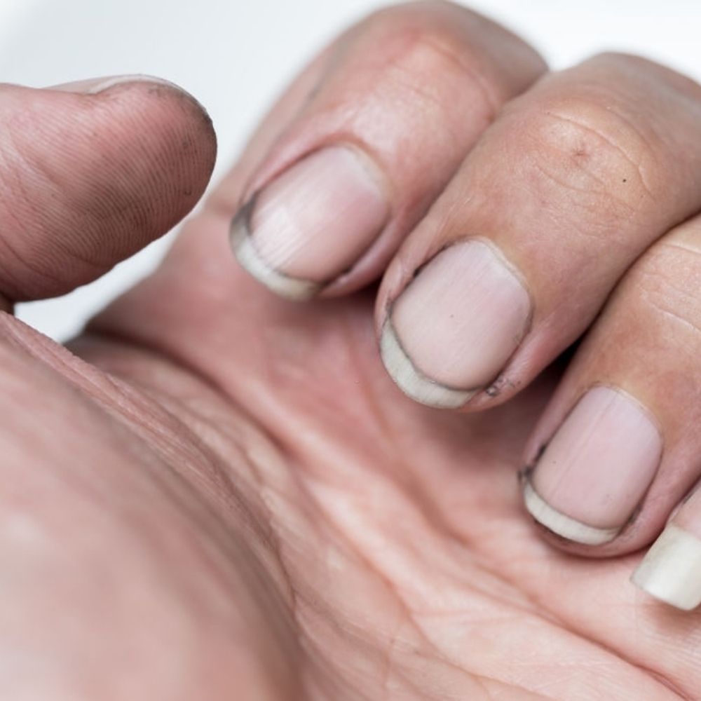 Why Do I Always Have Dirt Under My Nails & How to Get Rid of It?