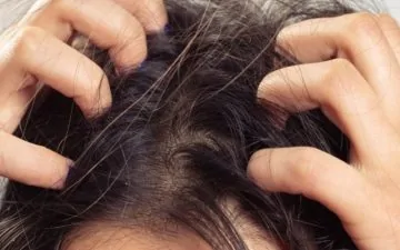 will dying hair kill lice