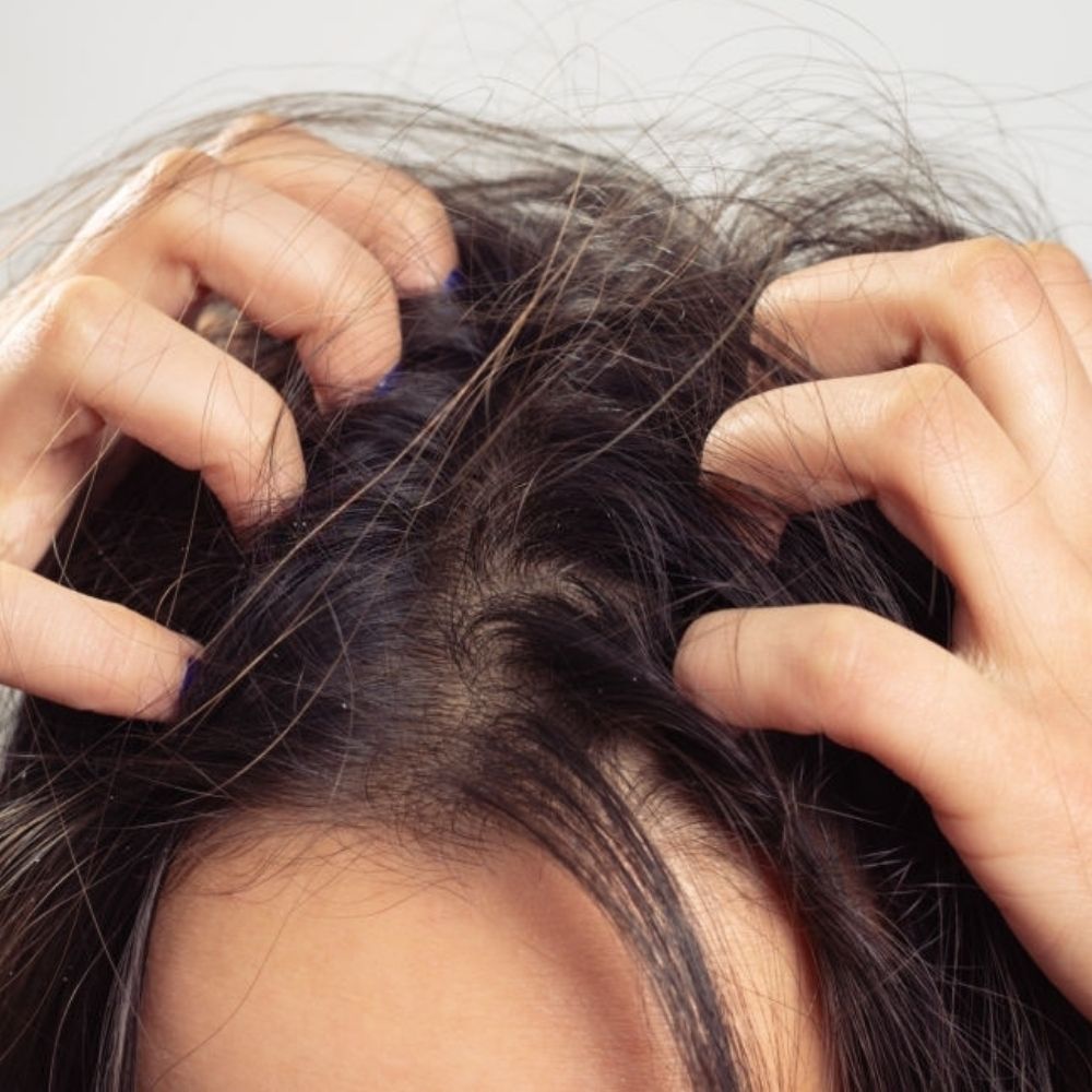 Does Hair Dye Kill Lice? How to Get Rid of Lice Using Hair Color Does Hair Dye Kill Lice? How to Get Rid of Lice Using Hair Color