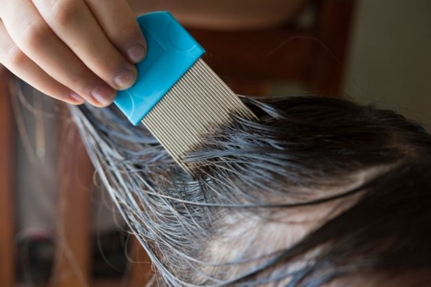 Does Hair Dye Kill Lice How To Get Rid Of Lice Using Hair Color