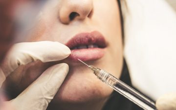 What To Know Before Getting Botox