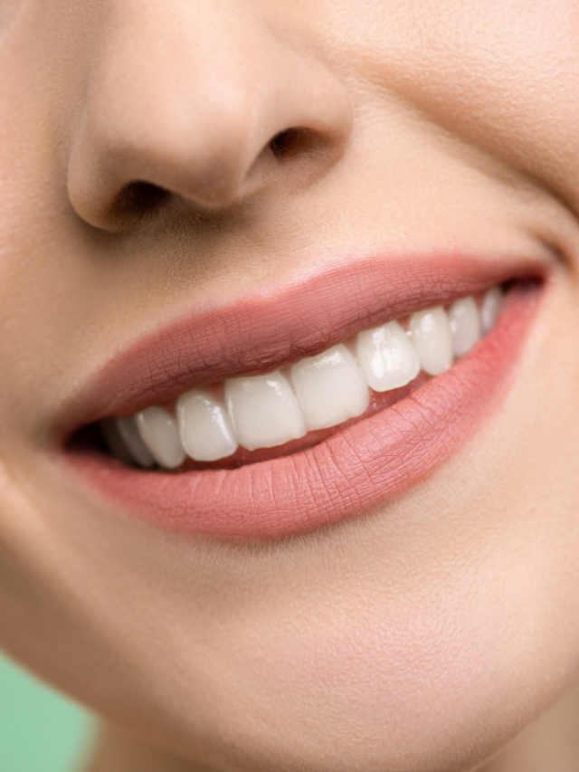 Whitening Bonded Teeth: Perfect Your Smile