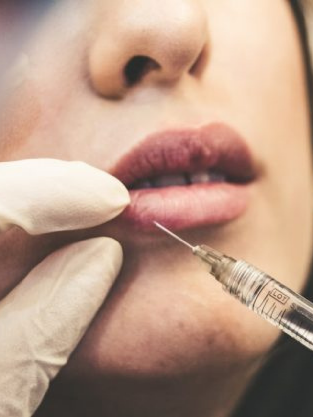 Read This Before Getting Botox!