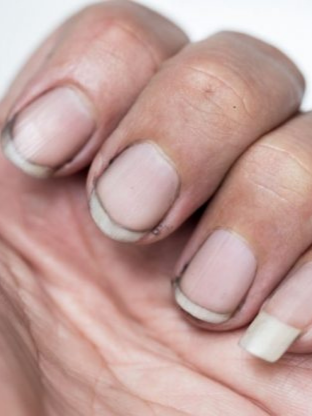 Dirt Under Your Fingernails: How to Keep It Clean